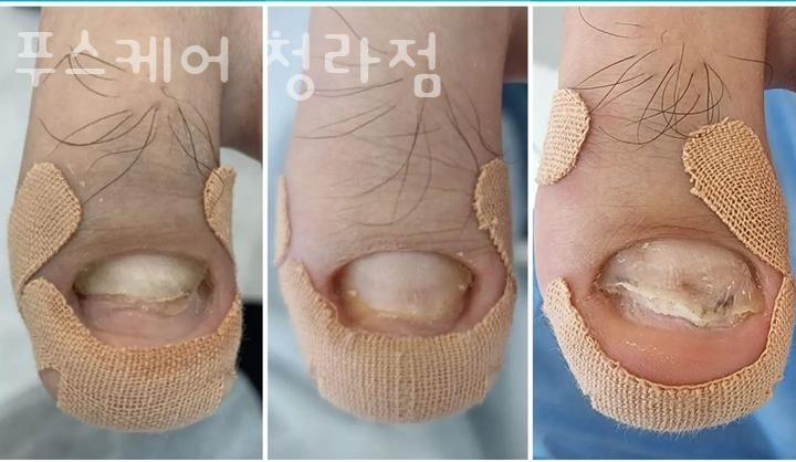 푸스케어 청라점 이미지