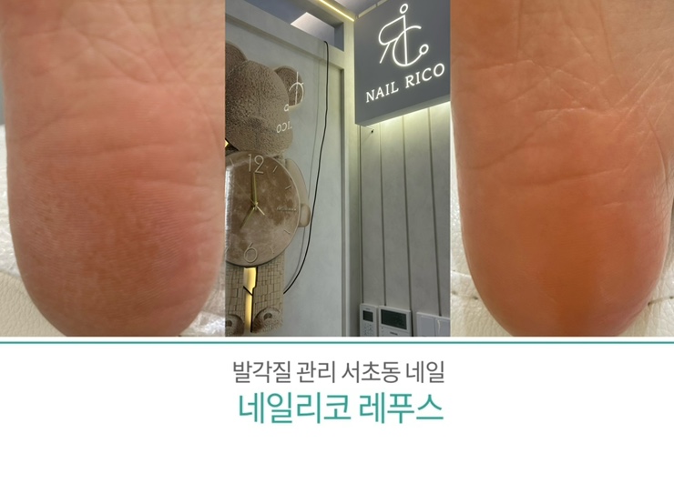네일리코레푸스 이미지
