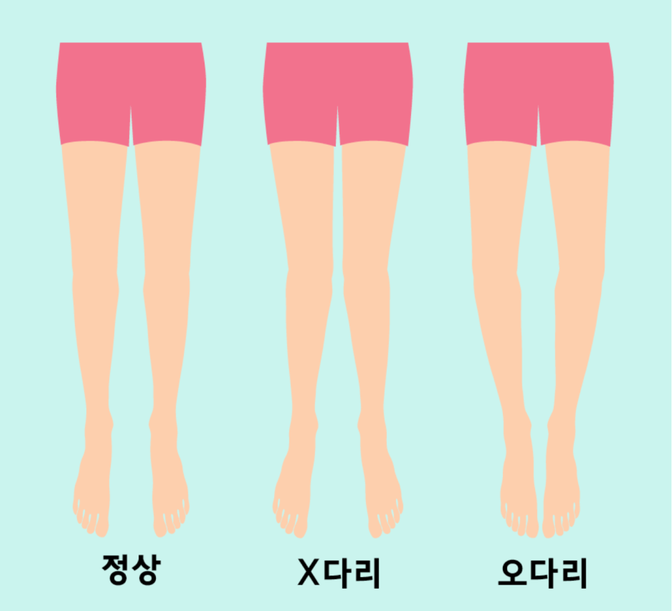 철다리 이미지