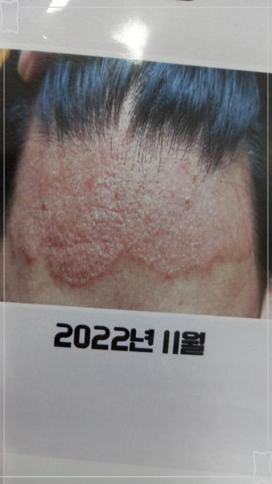 바른건강 이미지