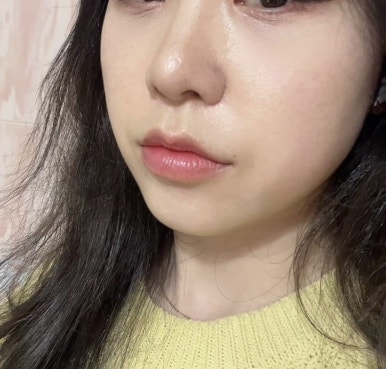 티엘바이정 이미지