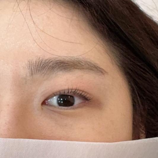올단 이미지