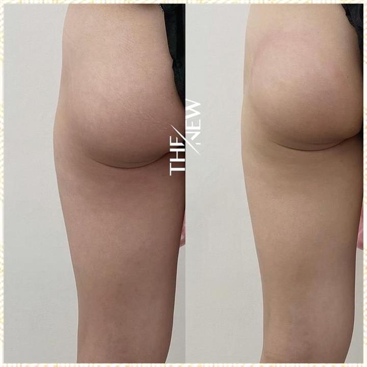뷰티온 이미지