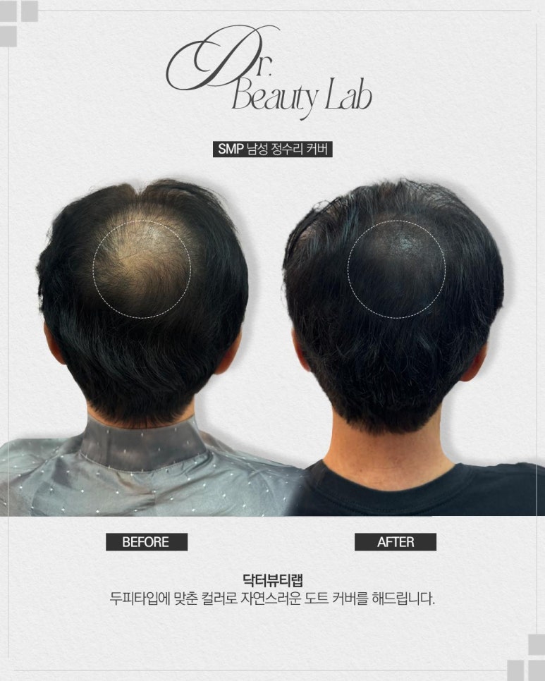 하이엔드뷰티 이미지