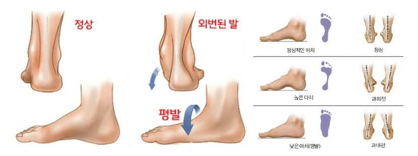 바른습관PT 이미지