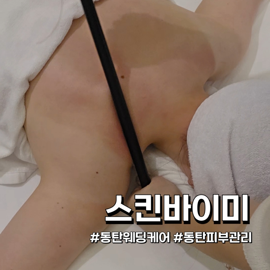 스킨바이미 이미지