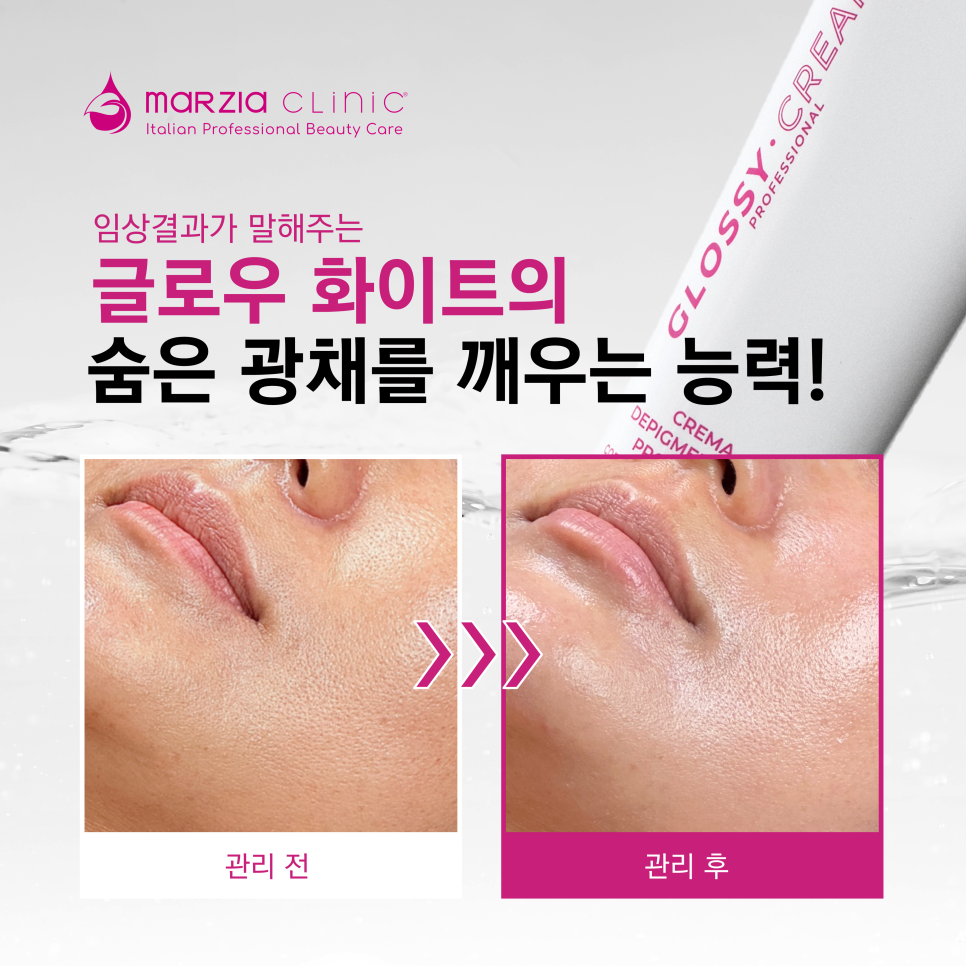 화이트크리닉 이미지