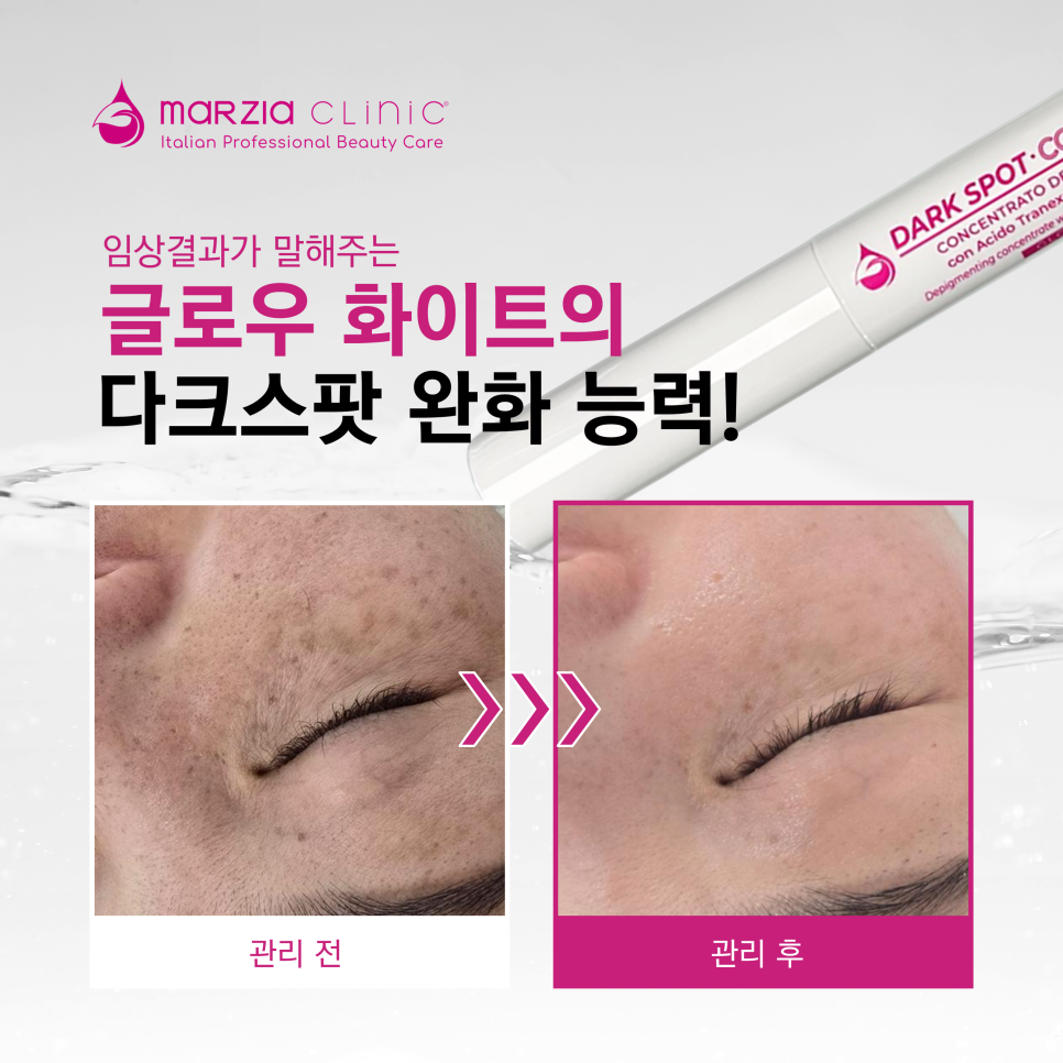 화이트크리닉 이미지