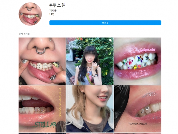 잠실원치과의원 이미지