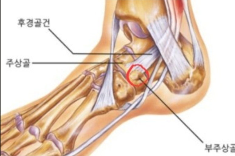 머슬제이 이미지