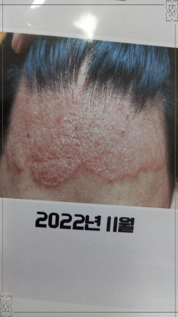 비고르바른건강 이미지