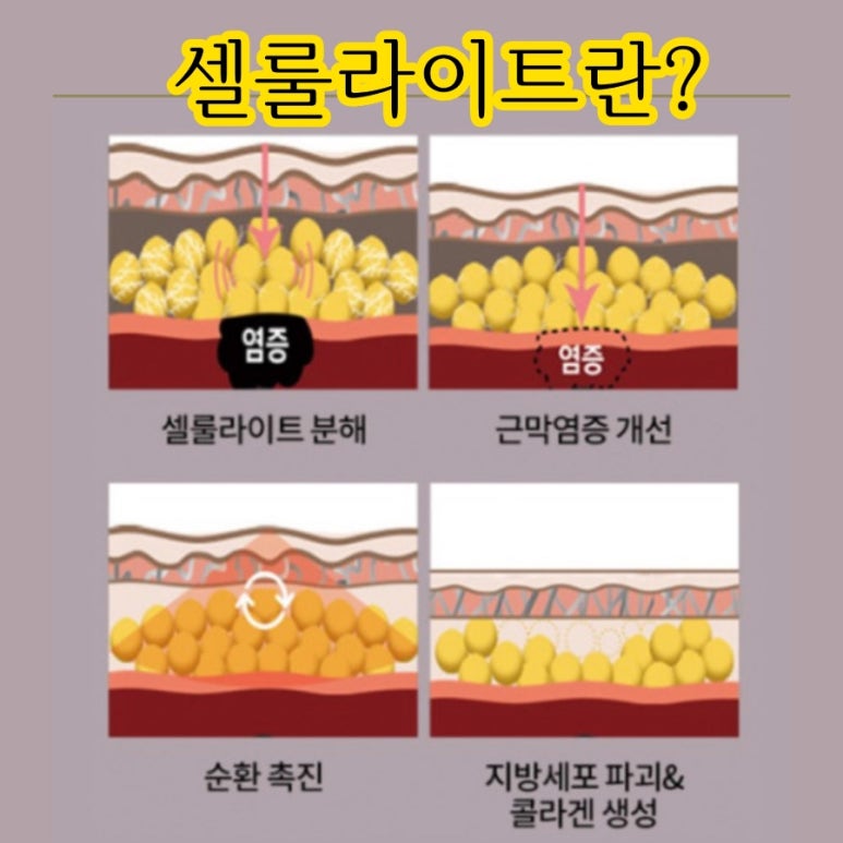 문샵 이미지