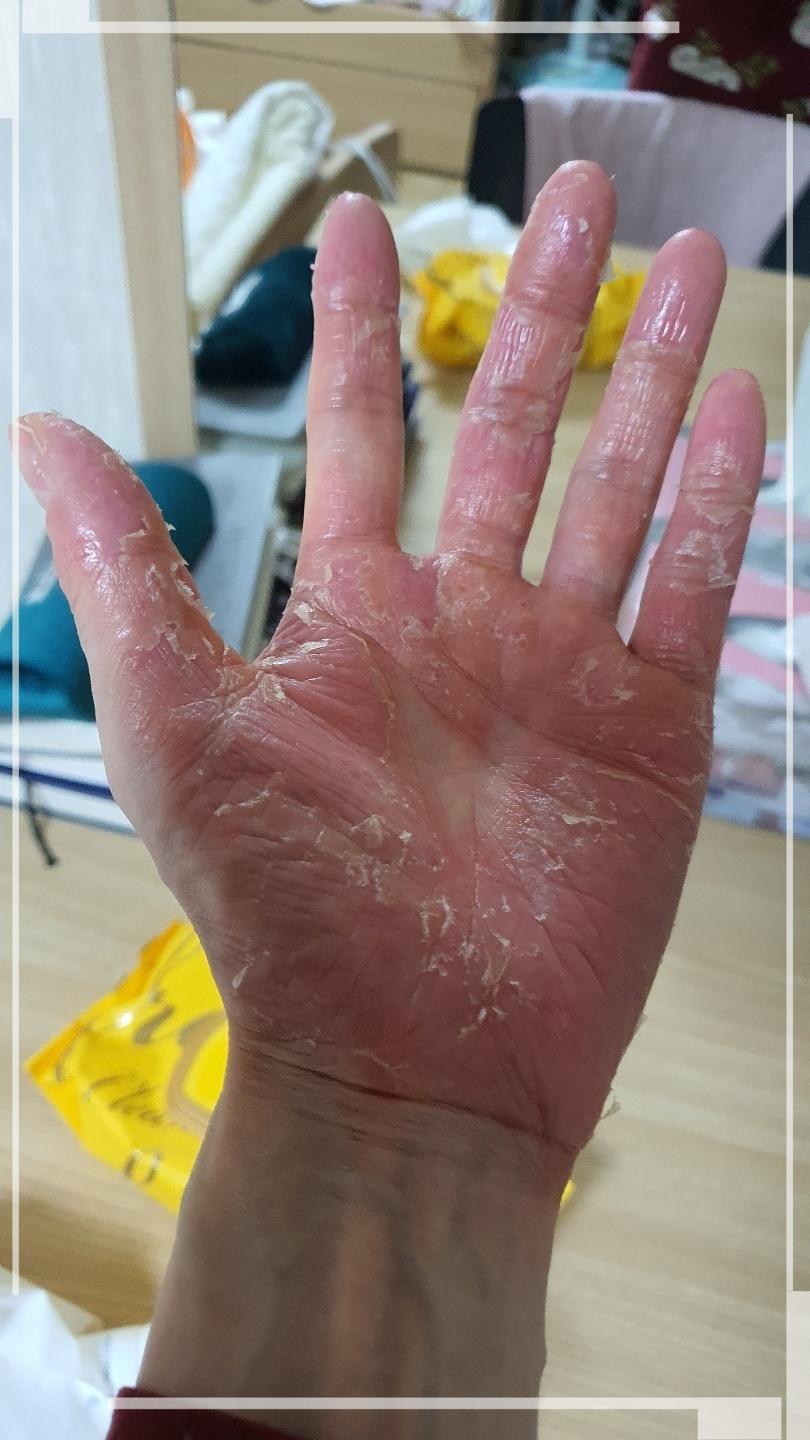 비고르바른건강 이미지