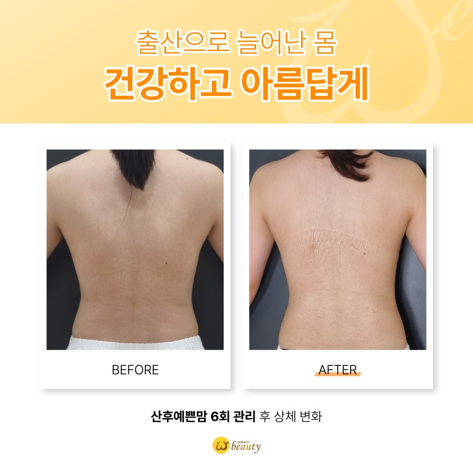 위뷰티 이미지