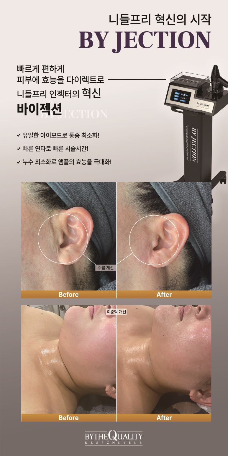 아이모드 이미지