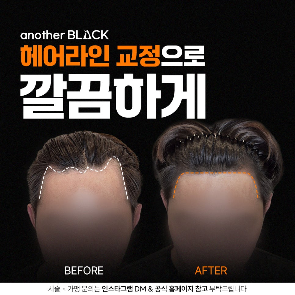 어나더헤어 이미지