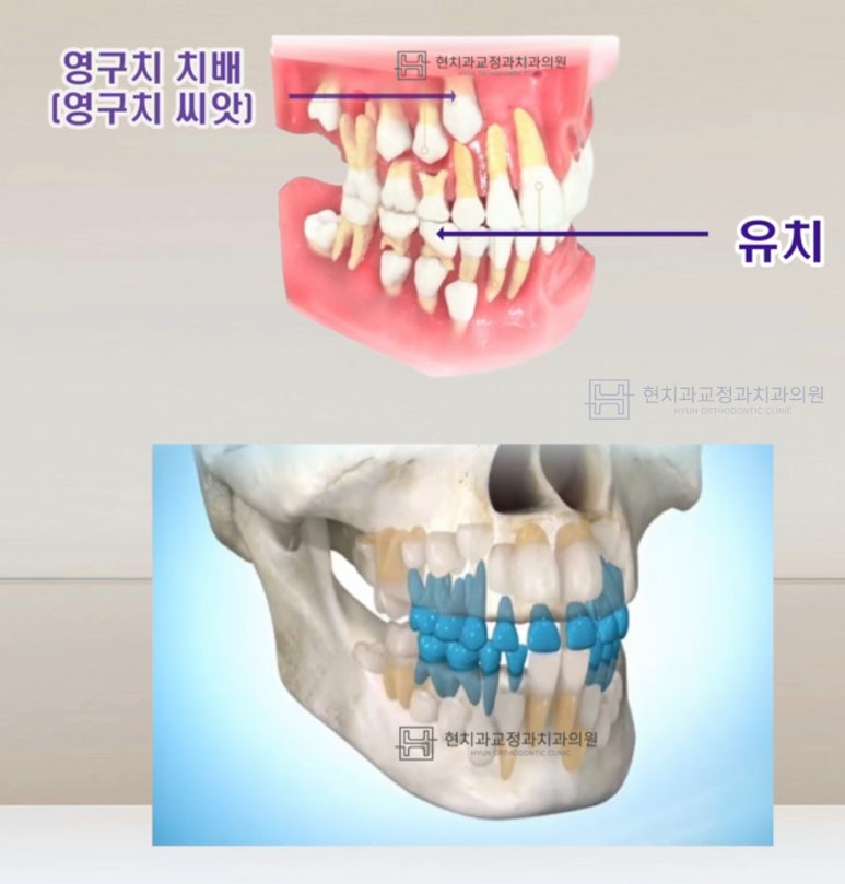 현치과교정과치과의원 이미지