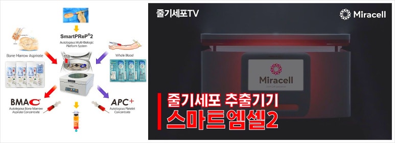 엠179 이미지