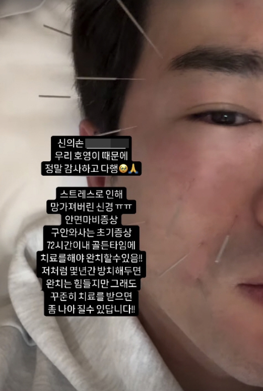 안면가스 이미지