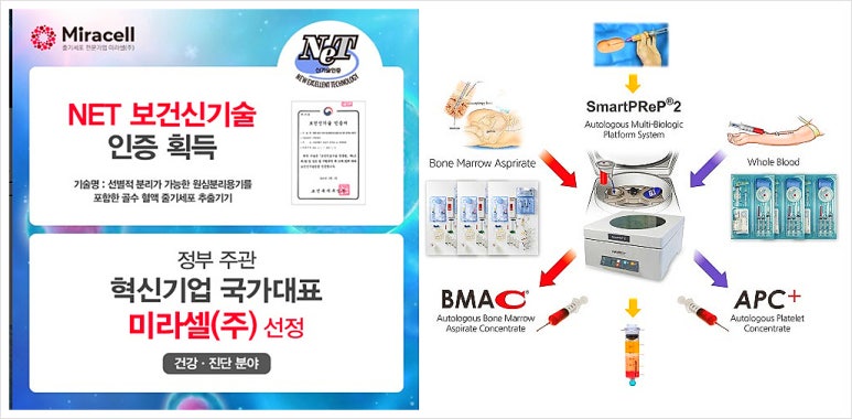 엠179 이미지