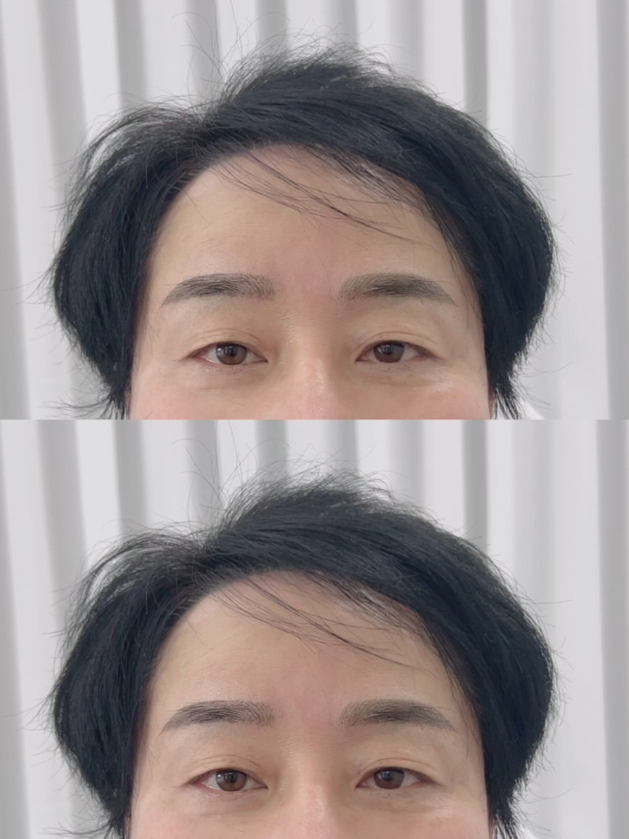아이룸뷰티 이미지