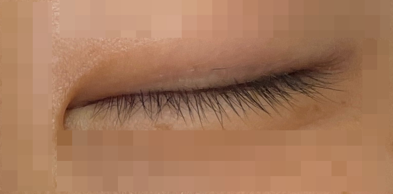 수인래쉬 이미지
