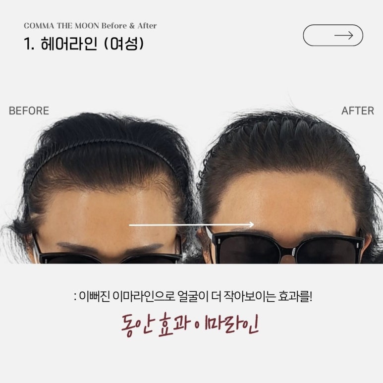 콤마더문 이미지