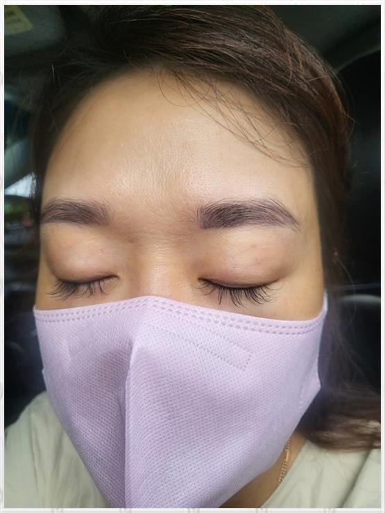 비비드스킨 이미지