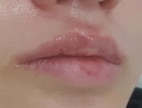 헬로슈가 이미지