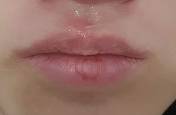 헬로슈가 이미지