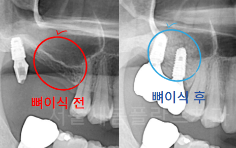 서울새봄플란트치과의원 이미지