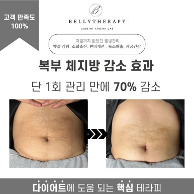 원테라피 이미지