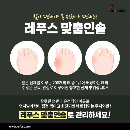레푸스 이미지