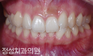 가지런한치과교정과치과의원 이미지