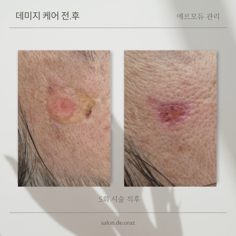 오르아즈 이미지