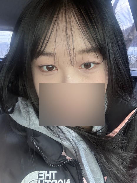 강남더뷰티성형외과의원 이미지