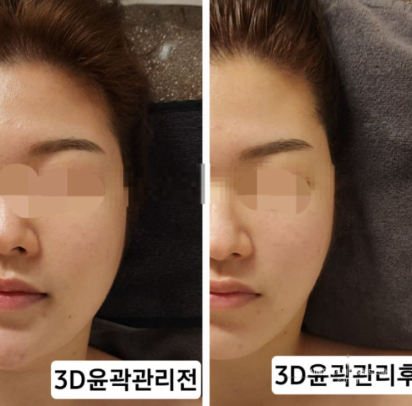 혜원에스테틱 이미지