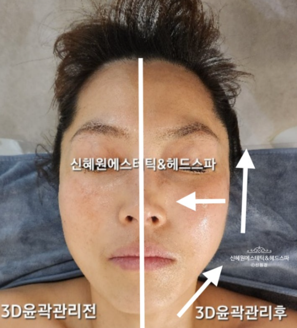 혜원에스테틱 이미지