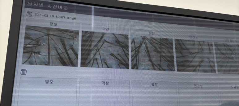 탑스칼프 구로디지털점 이미지