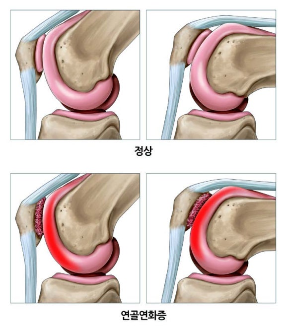 피지오스 이미지