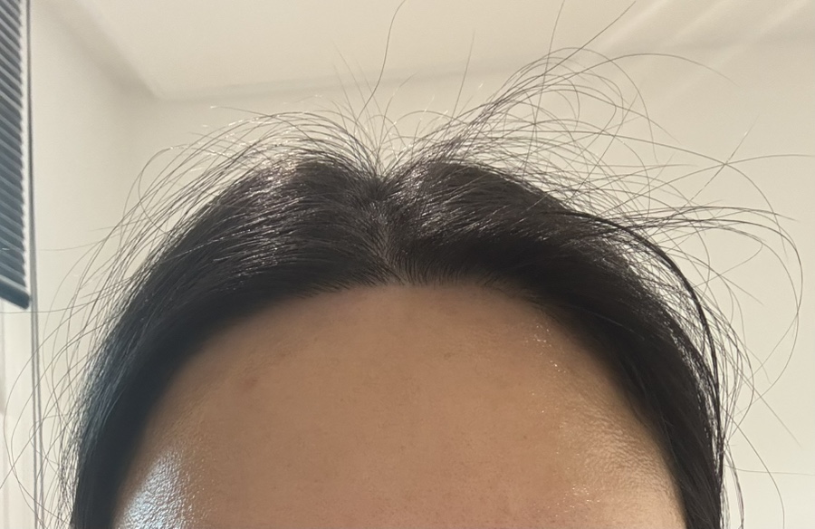 모모헤어라인 이미지
