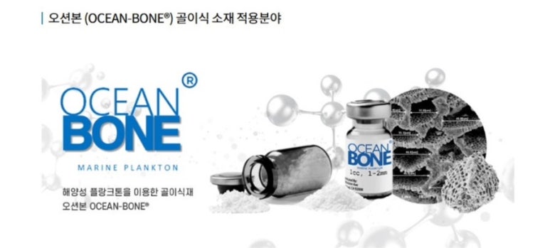 셀코 이미지