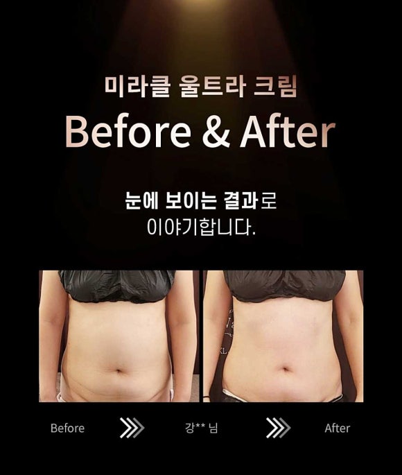 꿀체형관리 이미지