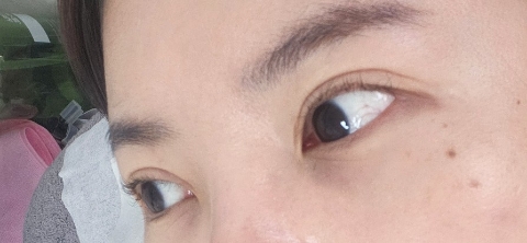 비니래쉬앤뷰티 이미지