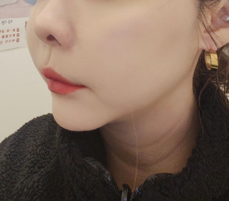 핸드경락 이미지