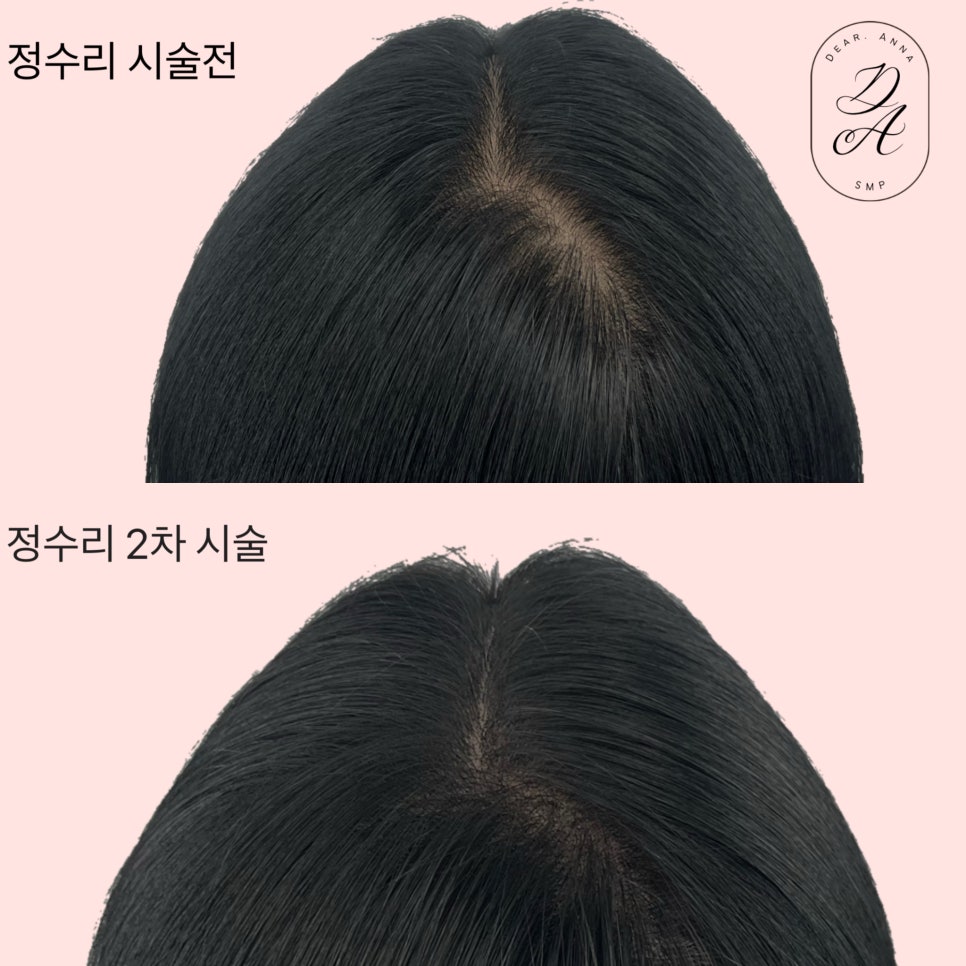디어니즈 이미지
