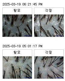 모클락 이미지