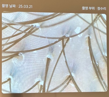 도노포레스타 이미지