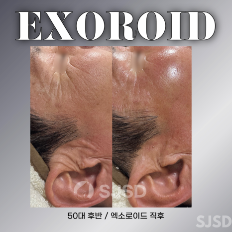 이터널스킨 이미지