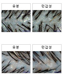 모클락 이미지